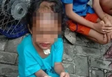 Balita Disiksa Paman dan Bibi di Surabaya, Ayah Korban Buka Suara